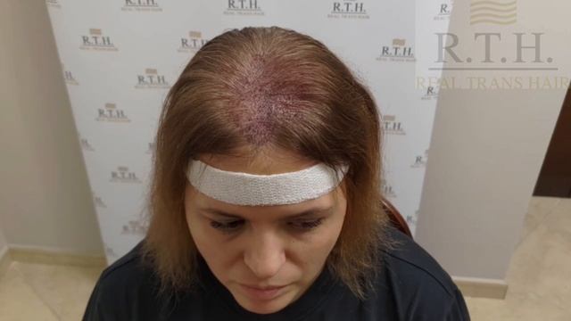 Шоковое выпадение волос смотреть онлайн