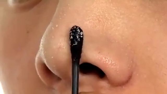 CIRACLE Good-Bye Blackhead смотреть онлайн