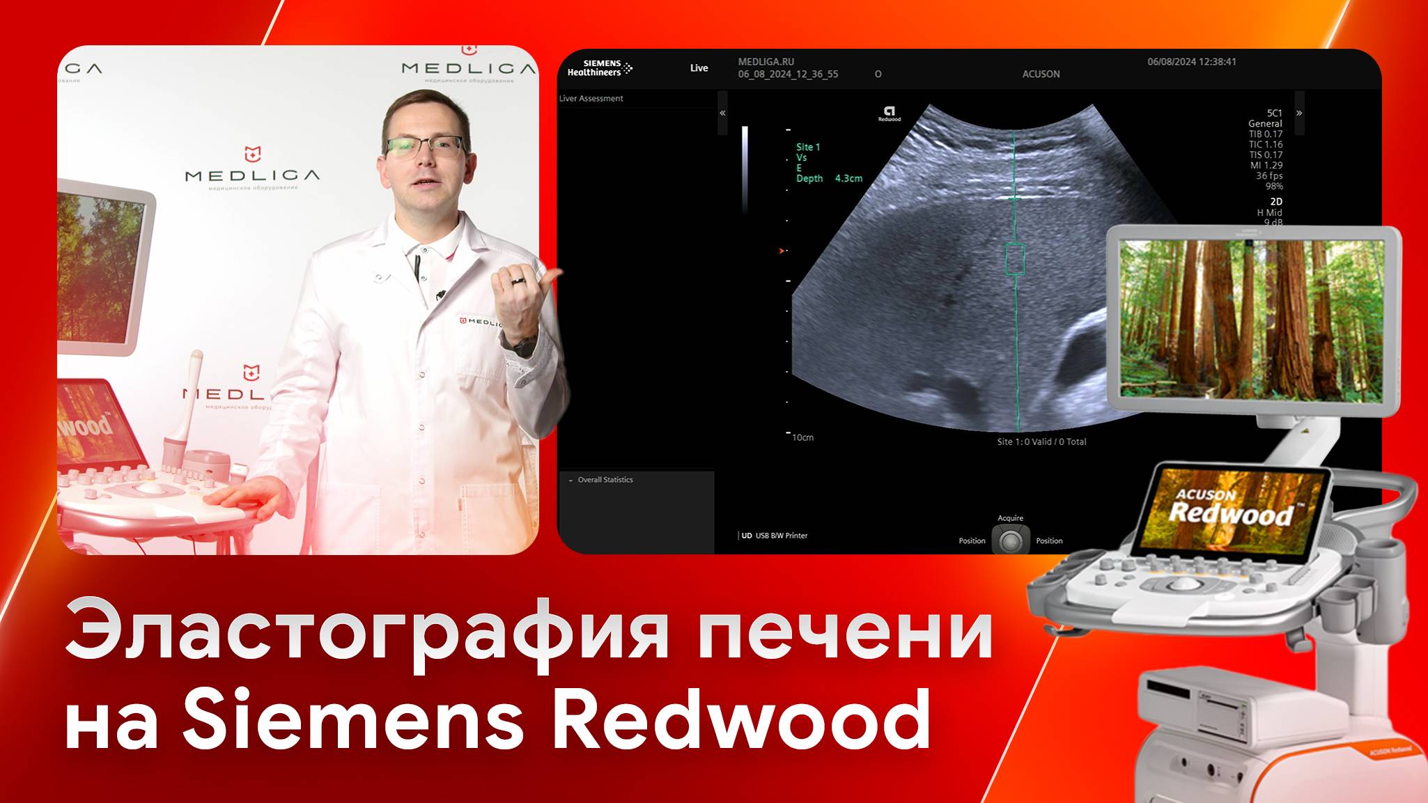 Техника проведения эластографии печени на Siemens Acuson Redwood смотреть онлайн