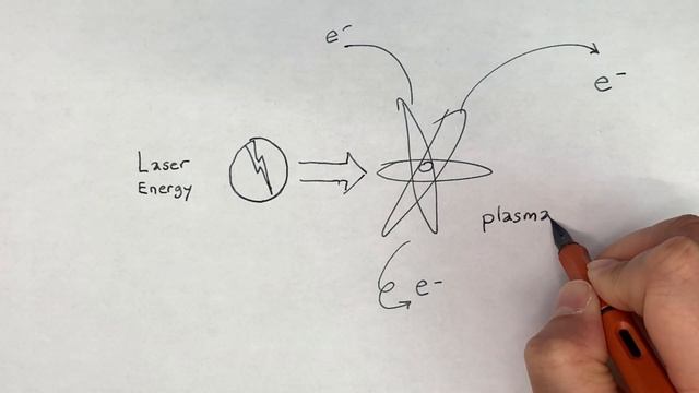 Yag Laser Capsulotomy for Posterior Capsule Opacification смотреть онлайн