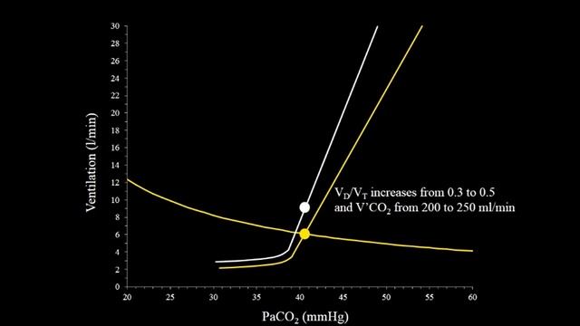 2 Determinants of respiratory drive Georgopoulos Dimitrios (ARF-18)