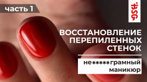 ВОССТАНОВЛЕНИЕ СТЕНОК! ЧАСТАЯ ПРОБЛЕМА И КАК ЕЕ РЕШАТЬ!