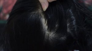 ASMR Scalp Check / Big Flakes / Toothbrush / Scratching / Combing Relax For Sleep
