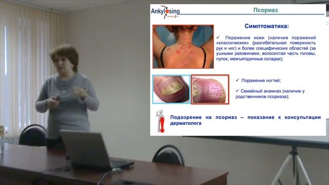 Дубинина Т.В. "Послушайте, доктор..".Лекция на тему "На чем акцентировать внимание ревматолога" смотреть онлайн