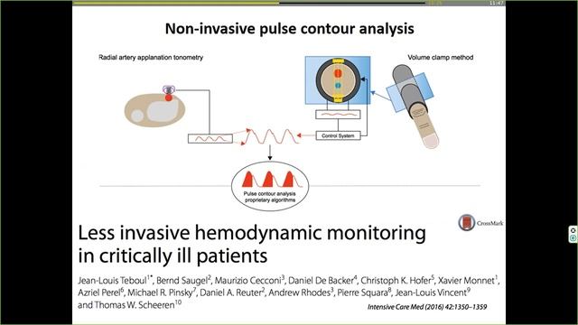 12 Cardiac output monitoring Invasive or non invasive Thomas Scheeren (H_dyn2017) (2)