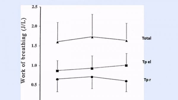 Which weaning winning strategies Brochard Laurent 2013