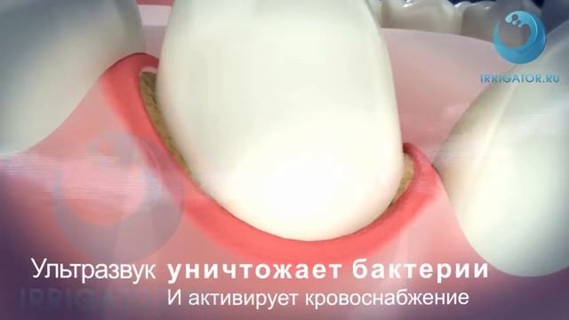 Как работает ультразвуковая зубная щетка Emmi dent 6 смотреть онлайн
