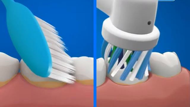 The Benefits of Electric Toothbrushes смотреть онлайн