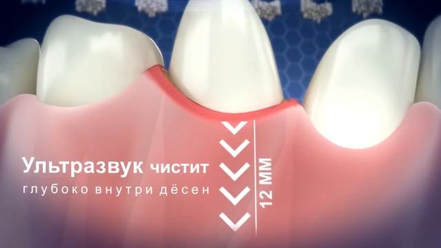 Emmi dent Russian Animation смотреть онлайн