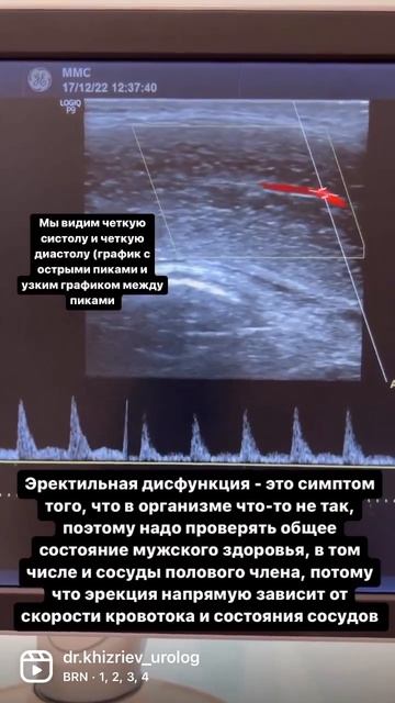 Доплерография сосудов ПЧ смотреть онлайн
