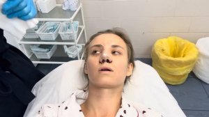 Ринопластика. VLOG//моя история. Как выбирала врача? Цена? ДО и ПОСЛЕ