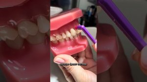 Что такое монопучковая зубная щетка и как ей пользоваться?