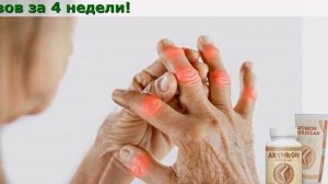Arthron Meridian Что Это Такое, Применение, Купить, Отзывы