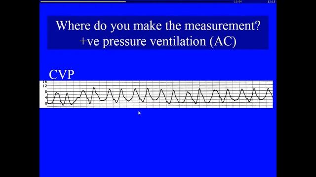 16 Is CVP useful Pro Sheldon Magder (H_dyn2017)