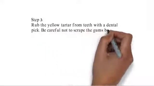 332 This Can Even Whiten Yellow Teeth And Remove Plaque And Tartar смотреть онлайн