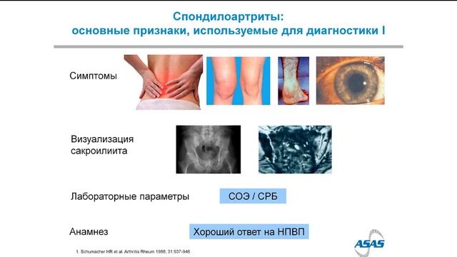 Лучихина Е.Л.: Лечение анкилозирующего спондилита. Школа для пациентов в Московской области смотреть онлайн