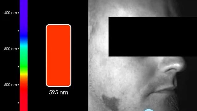 Photon etc. - Dermatological example смотреть онлайн