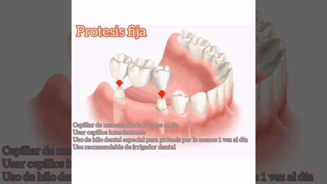 cuidado prótesis dentales смотреть онлайн