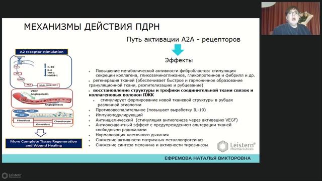 NucleoForm как альтернатива филлерам.Терапевтический лифтинг мягких тканей препаратами NucleoForm