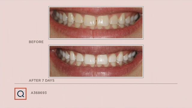 Smileactives Advanced Teeth Whitening Pen Trio Auto-Delivery on QVC смотреть онлайн