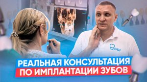 Опытный хирург-имплантолог Коннов М.И. БЕСПЛАТНАЯ КОНСУЛЬТАЦИЯ! Имплантация зубов.