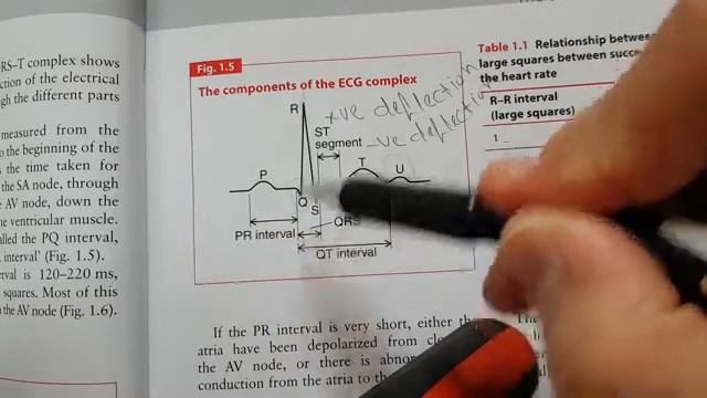 ECG normal waves and intervals. смотреть онлайн