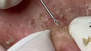 Enjoy Every Day With The Best Video Loan Nguyen Spa Official  2334