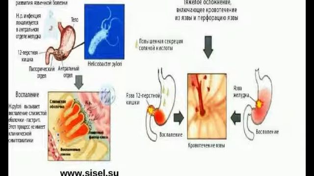 "Заболевания органов пищеварения" Н. Федоровская 03.06.2015 г. 20.00 смотреть онлайн