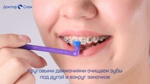 ТЕХНИКА ЧИСТКИ БРЕКЕТОВ МОНОПУЧКОВОЙ ЩЕТКОЙ