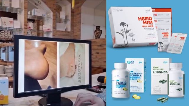 Как вылечить экзему Я больше не хромаю. смотреть онлайн