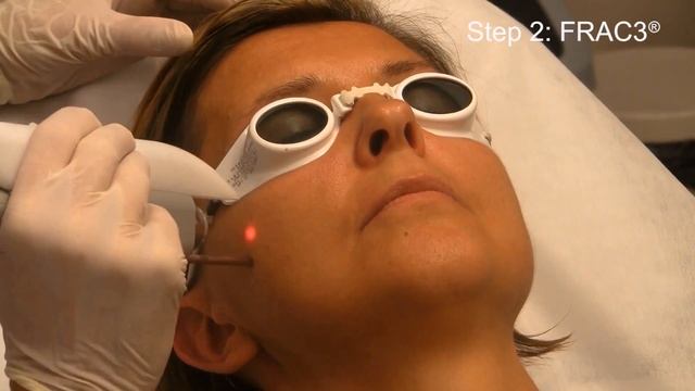EndoLifting FOTONA 4D