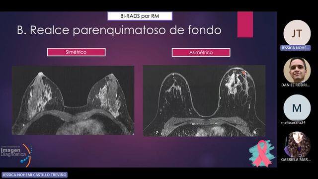 Resonancia Magnética de mama por la Dra. Jessica Castillo. смотреть онлайн