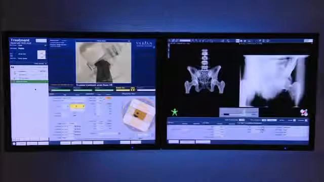 Varian TruBeam Prostate Video смотреть онлайн