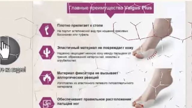 Фиксатор Вальгус Плюс смотреть онлайн