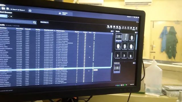 Recon, How to CT Recon,Siemens healthineers SOMATOM. go CT Scan. смотреть онлайн