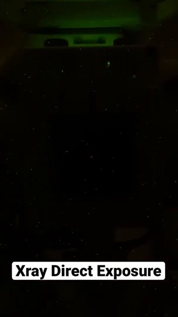 X-RAY Direct Exposure Recorded смотреть онлайн