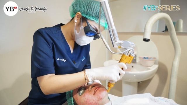 #YBSERIES EPISODE NEVUS OF OTA . TANDA LAHIR BISA ILANG ? BISALAH ! #REALBEAUTYSTORY #BEAUTYJOURNEY смотреть онлайн