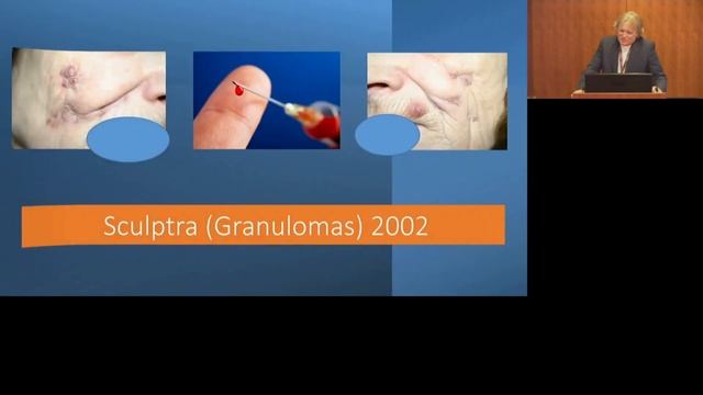 Dr Patrick Treacy lectures on Complications Series Sculptra (Series 3) смотреть онлайн