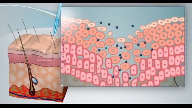 Jet Therapy at the Dr. Alex Chambers Clinic смотреть онлайн