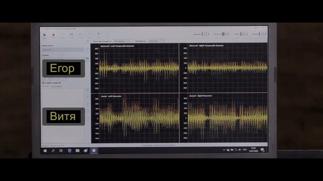Беспроводной электромиографичекий комплекс "Колибри" в практике реабилитолога Доктора Юдина смотреть онлайн