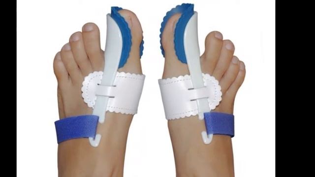 шарнирную вальгусную шину hallufix смотреть онлайн