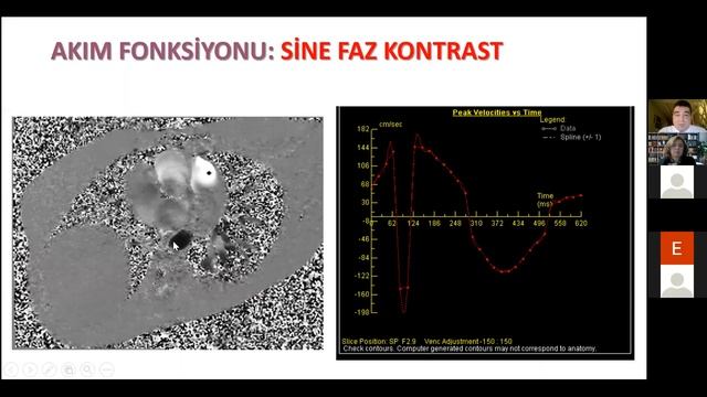 Prof.Dr. Tuncay Hazırolan Düzlemden Protokole Kardiyak MRG Trim смотреть онлайн