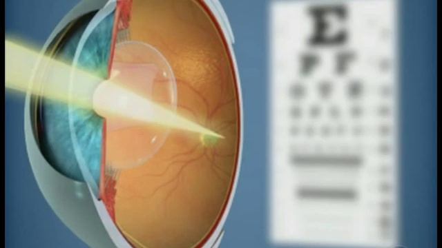 Lentes Faquitos Laser Vision Center смотреть онлайн
