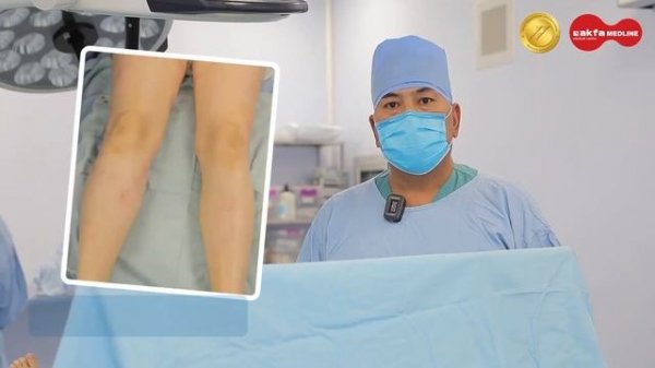 #варикоз #варикоз #тромб #склеротерапия #laser #varikozkasalligi #varikozdavolash