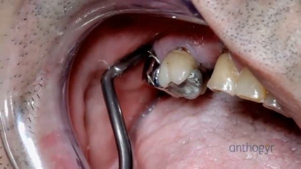 Anthogyr - Safe Relax