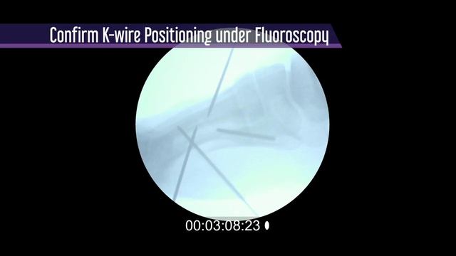 P28 Promo v10 смотреть онлайн