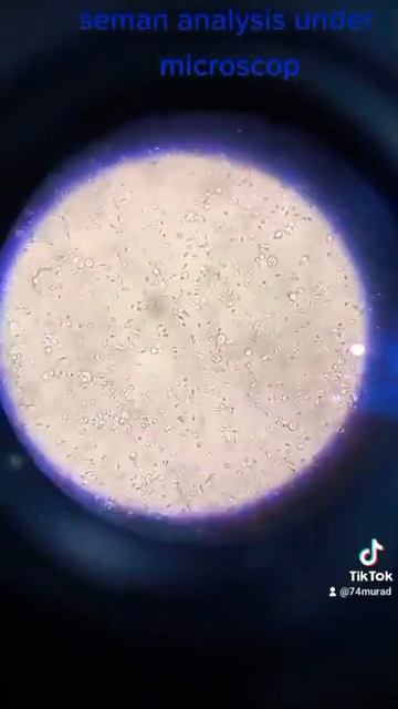 seman analysis under microscope. смотреть онлайн
