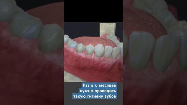Чистка зубов 🪥#отбеливаниезубов #белыезубы #чистказубов #стоматология смотреть онлайн