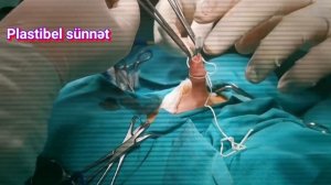 Sünnət ,circumcision