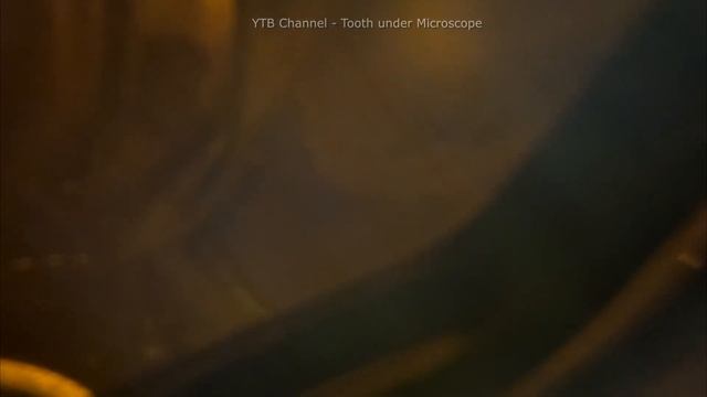 Sealing of root canals | Tooth under Microscope Dentist-therapist - 2024 смотреть онлайн